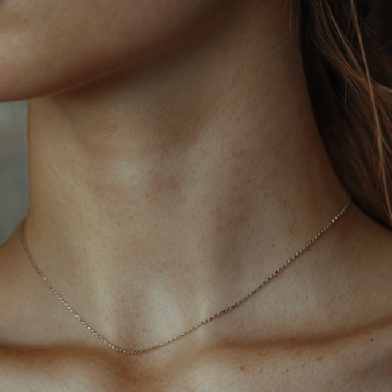 Neckrimpels: waarom ze gebeuren en hoe ze er vanaf kunnen komen